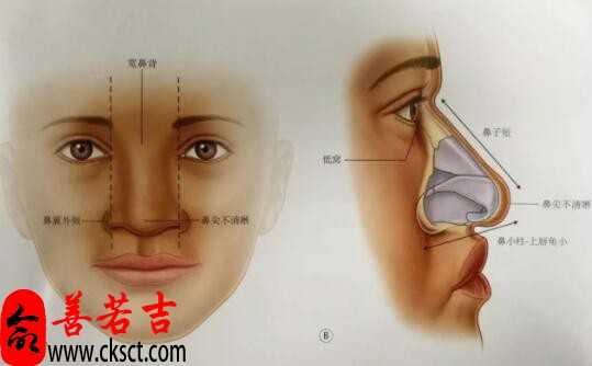 梦见鼻口周公解梦，梦见鼻口是什么意思？